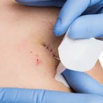 Minor Surgical & Procedural Care